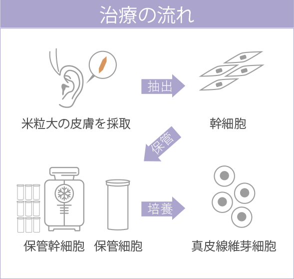 治療の流れの図