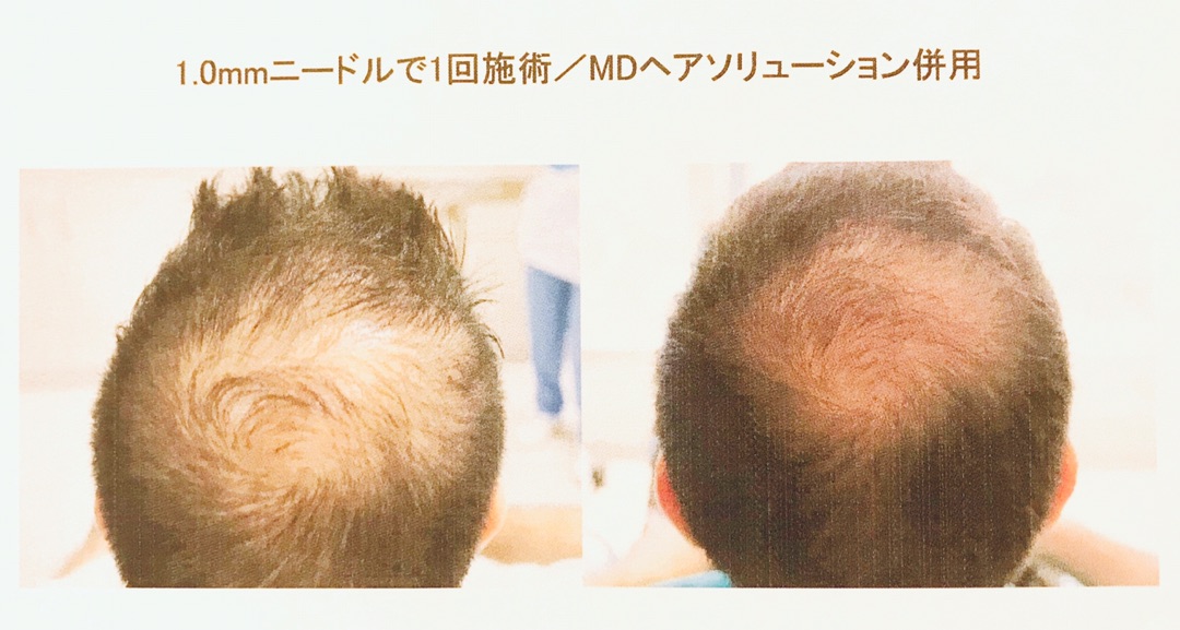 男性の症例写真