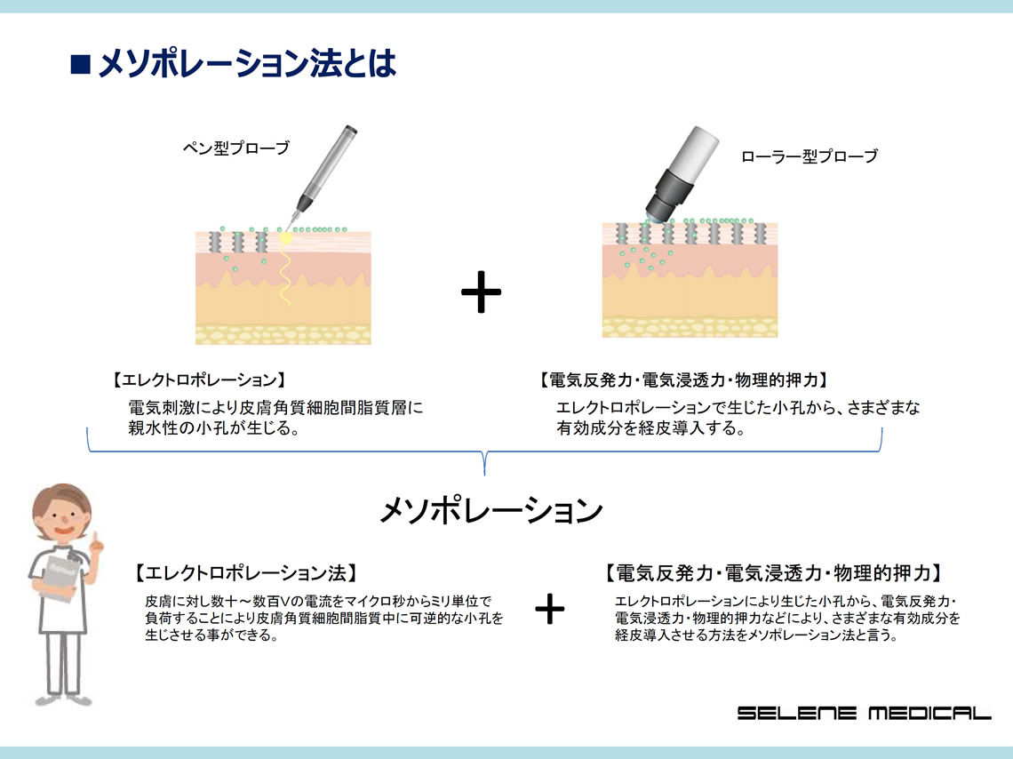 メソポレーションとは