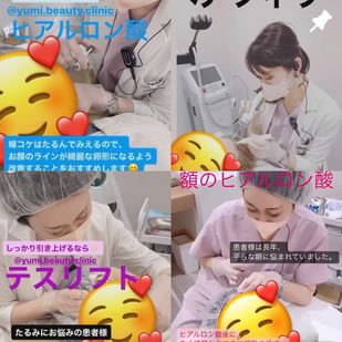 スタッフインスタグラム
