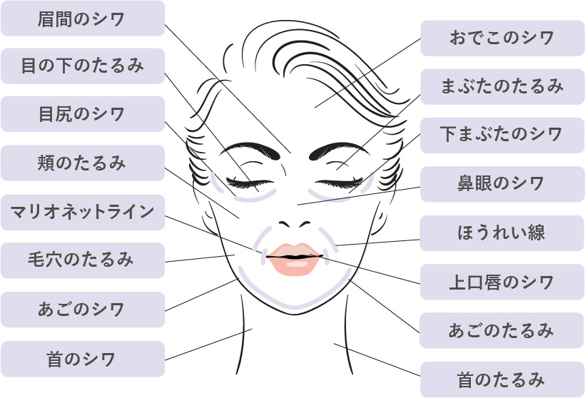 しわの種類の図