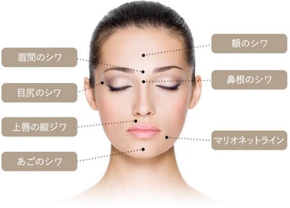 シワの箇所の説明画像