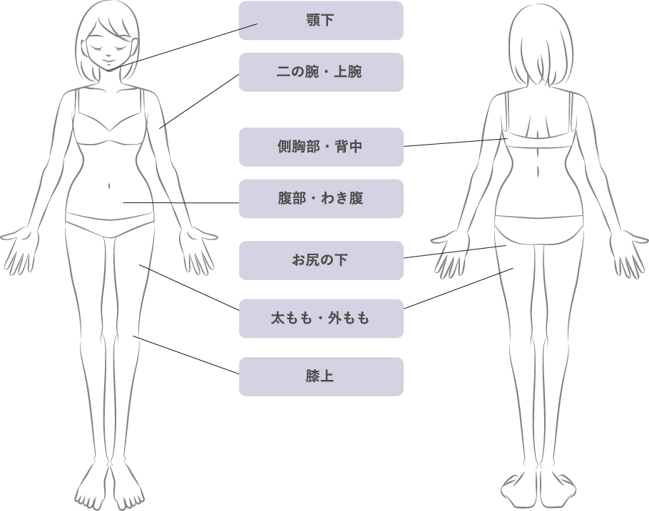 顎下、二の腕・上腕、側胸部・背中、腹部・わき腹、お尻の下、太もも・外もも、膝上