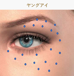 ジャルプロヤングアイの注入部位