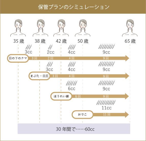 保管プランのシミュレーション