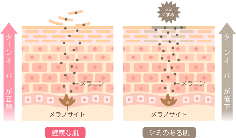 シミ・肝斑・くすみのメカニズム