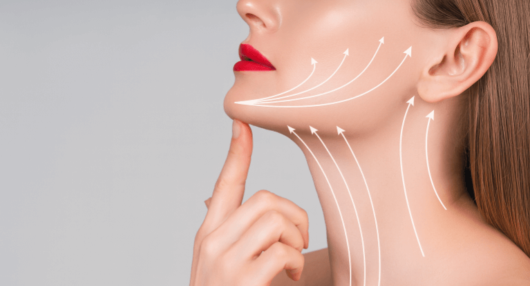 おまかせ糸リフト