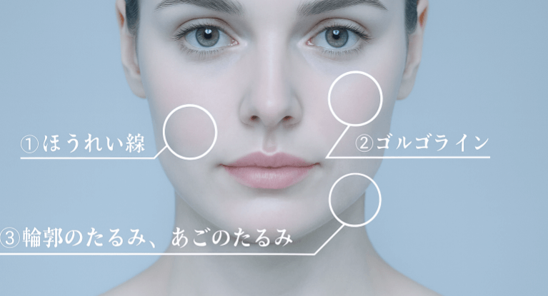 切らない、ダウンタイムが少ないたるみ改善治療です