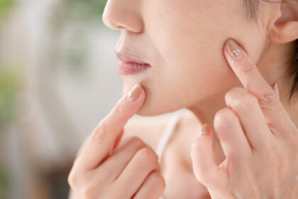 ぽにょりんとは・・・